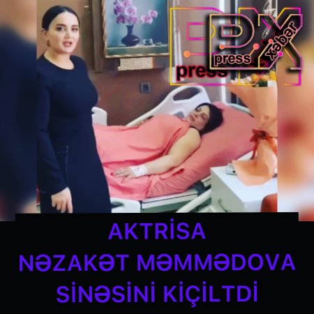 AKTRİSA SİNƏSİNİ KİÇİLTDİ