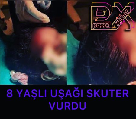 8 YAŞLI UŞAĞI SKUTER VURDU