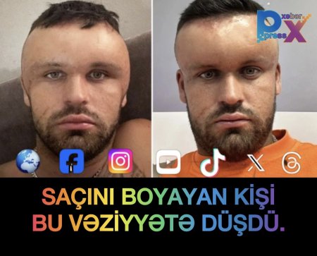 SAÇINI BOYAYAN KİŞİ DƏHŞƏT YAŞADI