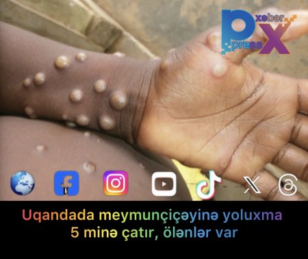 Uqandada meymunçiçəyinə........!